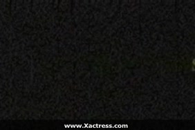 اشكال الكساس