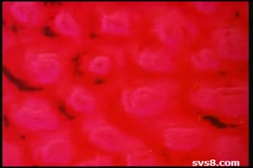 Vedyo xxx ardk